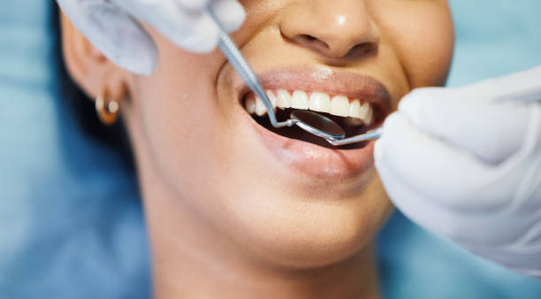 Best Emergency Dental Surgery in Moores Mill, AL