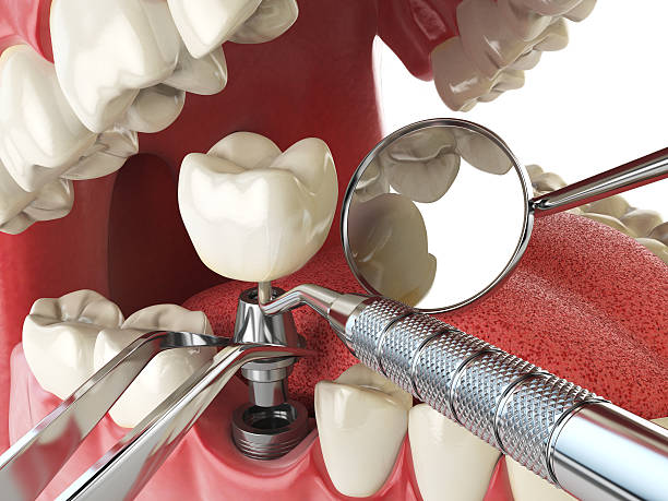 Best Emergency Dental Surgery in Moores Mill, AL